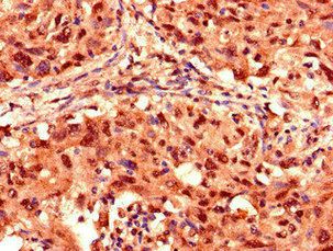 PSMD2 Antibody