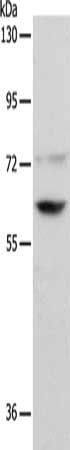 PSMD3 Antibody