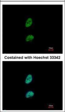 PSME3 Rabbit Polyclonal Antibody