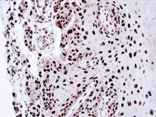 PSME3 Rabbit Polyclonal Antibody