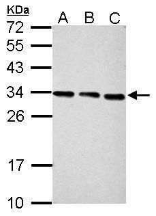 PSME3 Rabbit Polyclonal Antibody