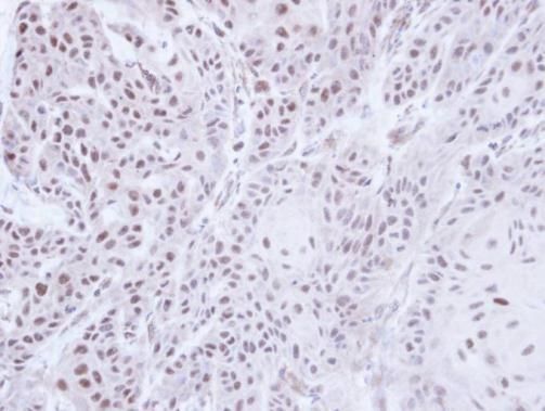 PSR Rabbit Polyclonal Antibody