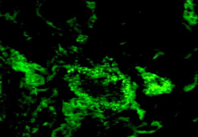 Patched Rabbit Polyclonal Antibody (FITC)