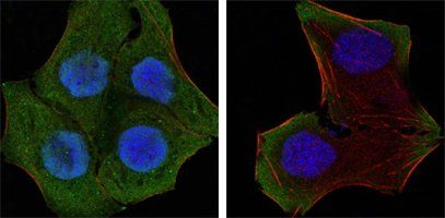 PTEN Antibody