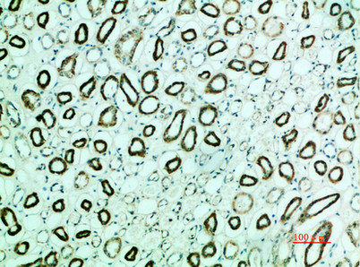 PTH1R Antibody