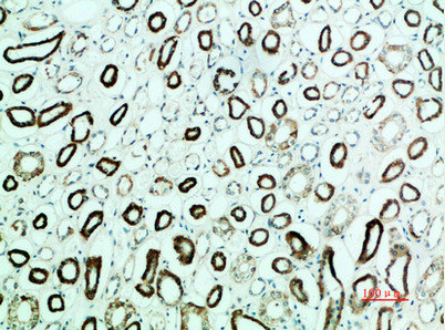PTH1R Antibody