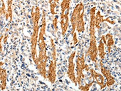 PTHLH Antibody