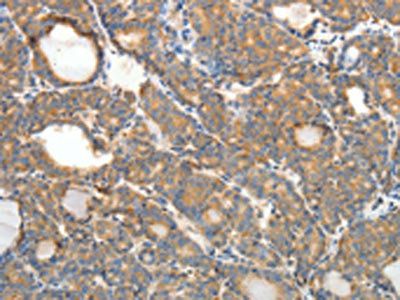 PTHLH Antibody