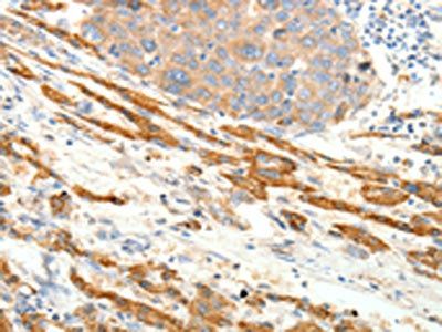 PTHLH Antibody