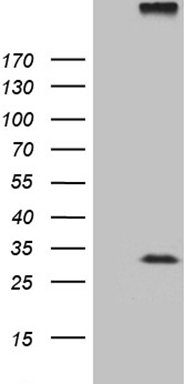 TWF1 Antibody