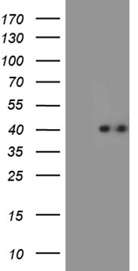 TWF1 Antibody