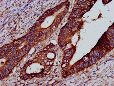PTP4A2 Antibody