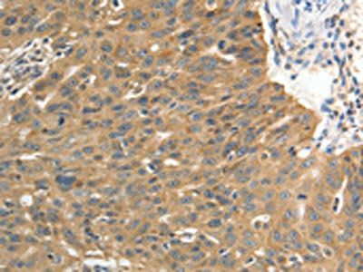 PTP4A2 Antibody