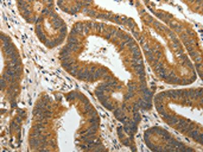 PTP4A2 Antibody
