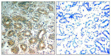 PTPN11 Antibody