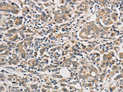 PTPN11 Antibody