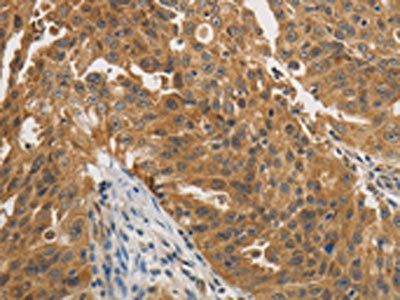 PTPN11 Antibody