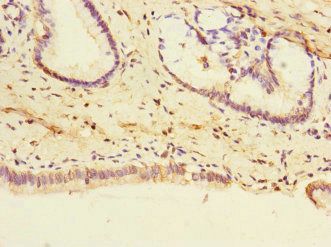 PTPN4 Antibody