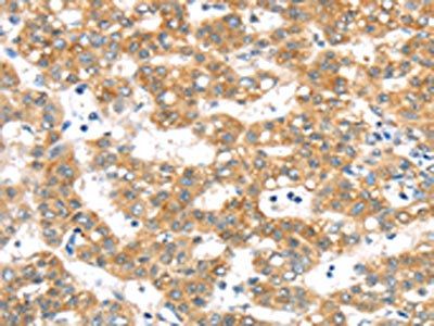 PTPN4 Antibody