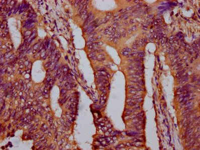 PTPN9 Antibody