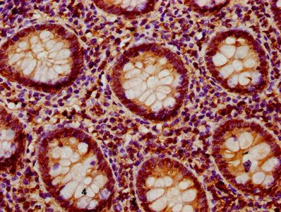 PTPN9 Antibody