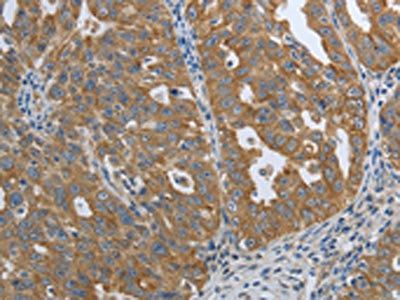 PTPRM Antibody