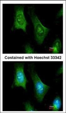 PTS Rabbit Polyclonal Antibody
