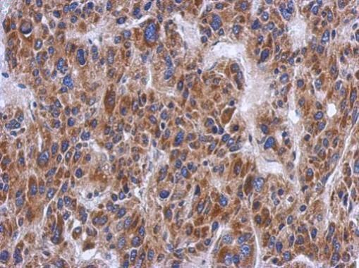 PTS Rabbit Polyclonal Antibody