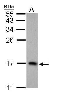 PTS Rabbit Polyclonal Antibody