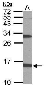PTS Rabbit Polyclonal Antibody