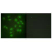 PTTG1 Antibody