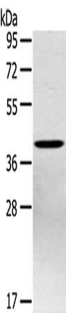 PTX3 Antibody