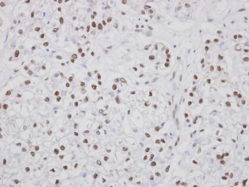 poly(U) binding splicing factor 60 Antibody