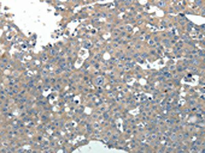PVALB Antibody