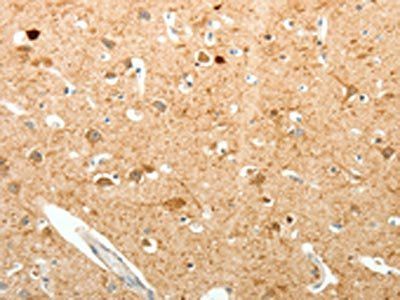 PVALB Antibody