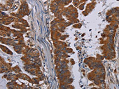 NECTIN3 Antibody