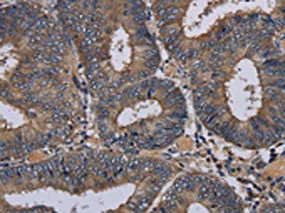 NECTIN3 Antibody