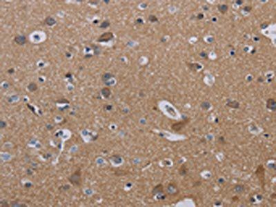 NECTIN3 Antibody