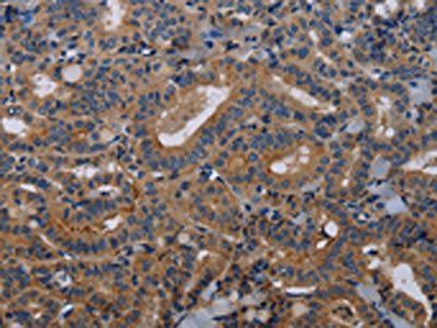 NECTIN3 Antibody
