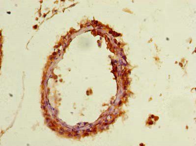 PYCR2 Antibody