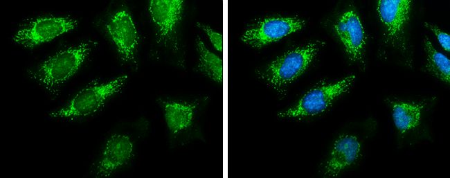 Pyruvate Dehydrogenase E1 alpha Rabbit Polyclonal Antibody