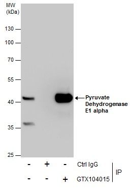 Pyruvate Dehydrogenase E1 alpha Rabbit Polyclonal Antibody