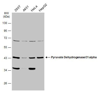 Pyruvate Dehydrogenase E1 alpha Rabbit Polyclonal Antibody