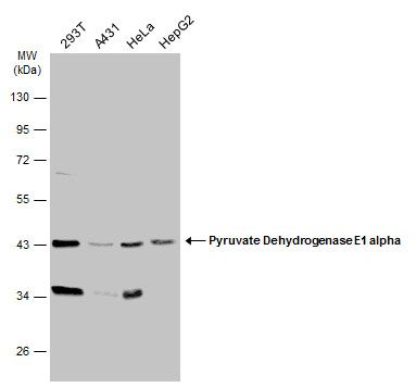 Pyruvate Dehydrogenase E1 alpha Rabbit Polyclonal Antibody