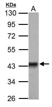 Pyruvate Dehydrogenase E1 alpha Rabbit Polyclonal Antibody