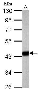 Pyruvate Dehydrogenase E1 alpha Rabbit Polyclonal Antibody