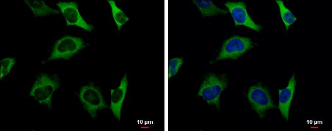 Pyruvate Kinase Rabbit Polyclonal Antibody