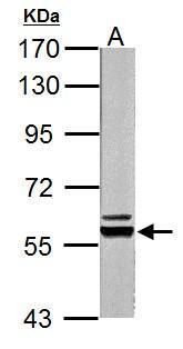 Pyruvate Kinase Rabbit Polyclonal Antibody