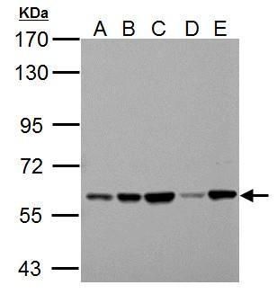 Pyruvate Kinase Rabbit Polyclonal Antibody