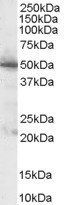 Pyruvate dehydrogenase/PDHX Antibody